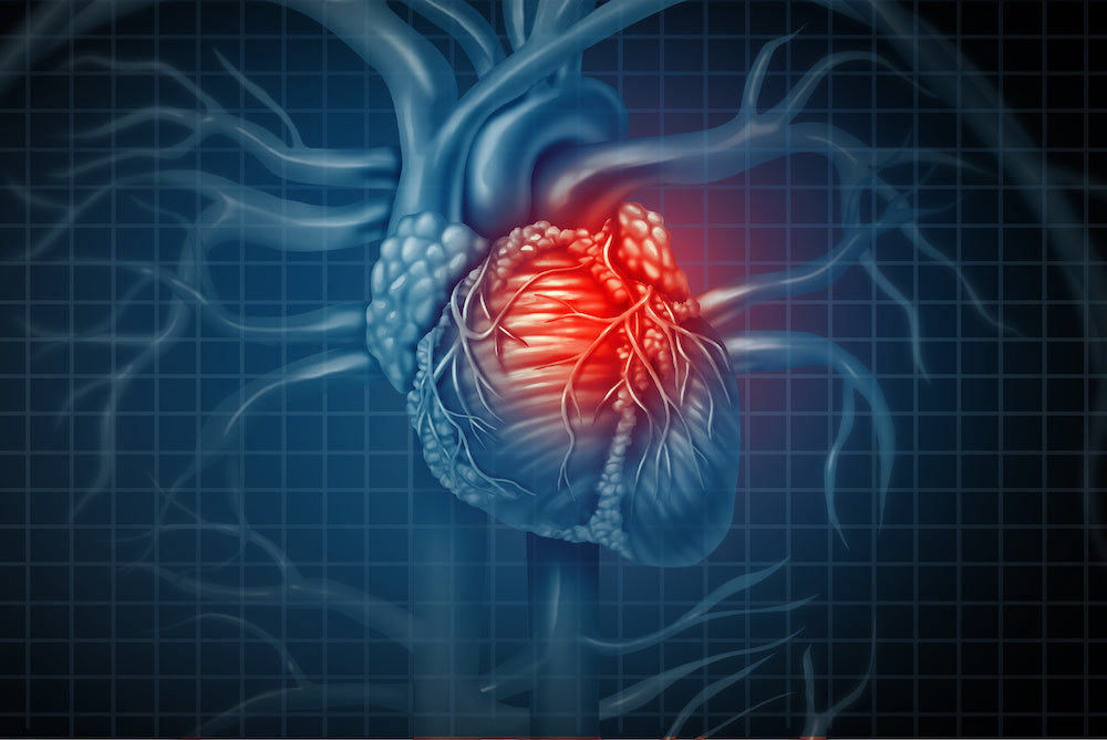 Cardiovascular Disease and Curcumin